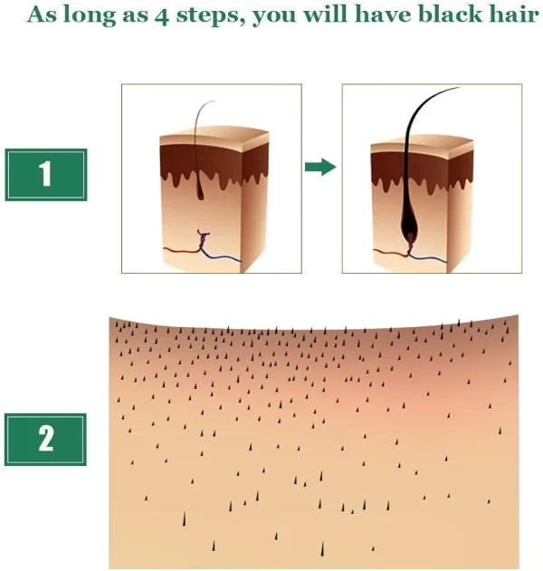 51HGX7sKXQL. AC UF10001000 QL80 FMwebp